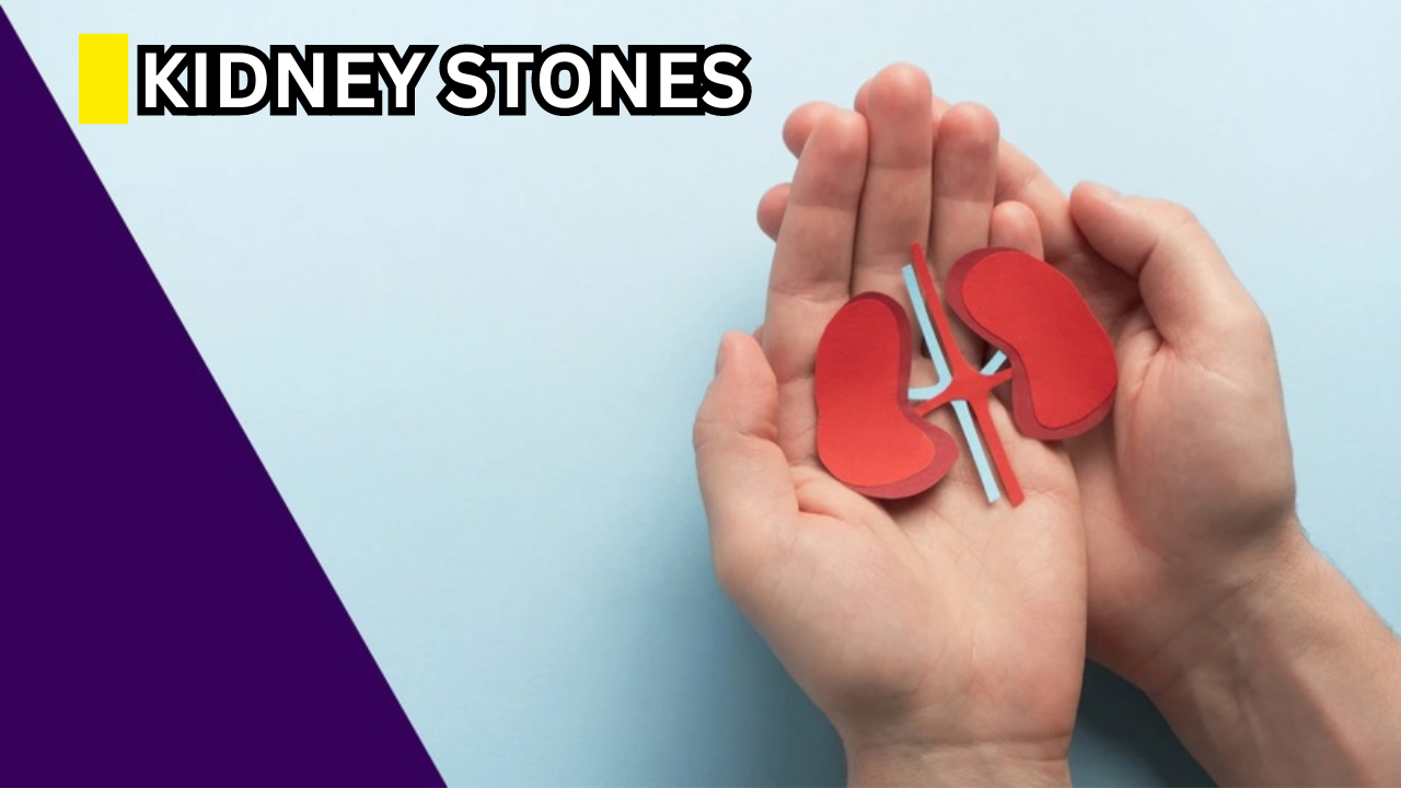 Kidney Stones | 5 Common Myths Cleared Up